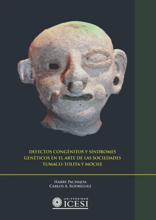 Defectos Congénitos Y Síndromes Genéticos En El Arte De Las Sociedades Tumaco-Tolita Y Moche